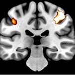 ValxLoc 300 dpi crop